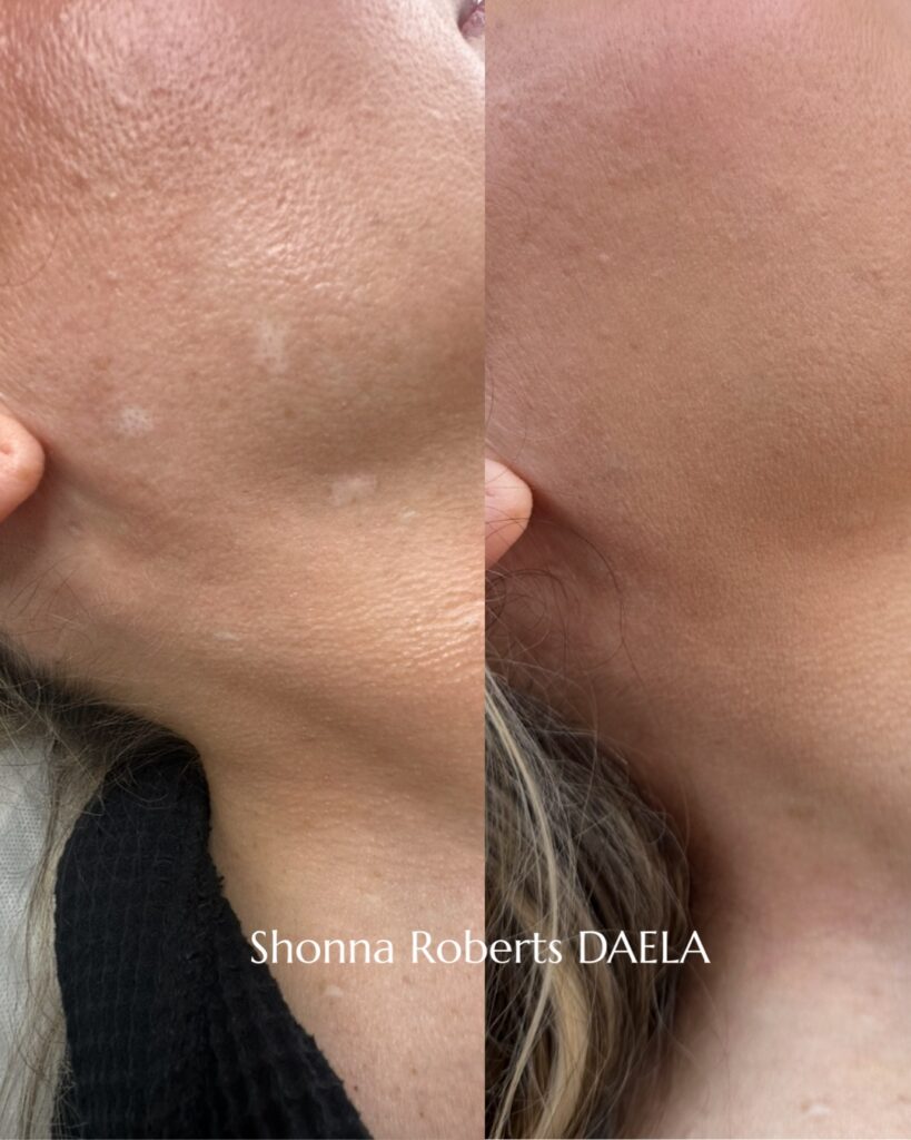 scar camo training daela academy