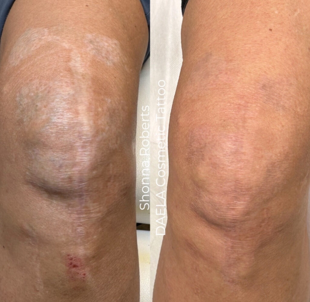 Scar Camouflage Training DAELA Academy