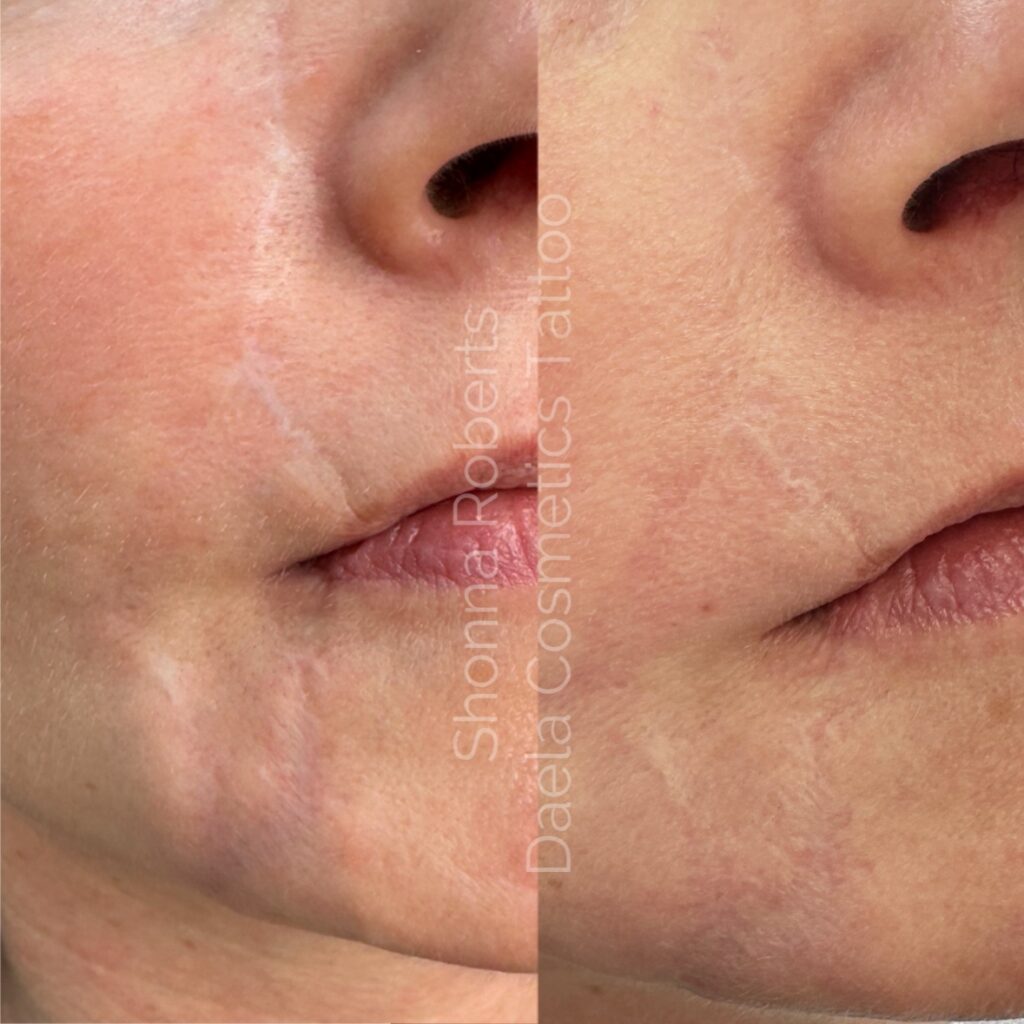 Learn Scar camouflage at DAELA Academy