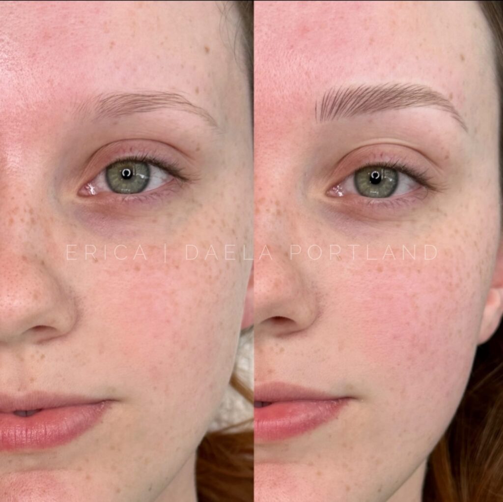 Microblading