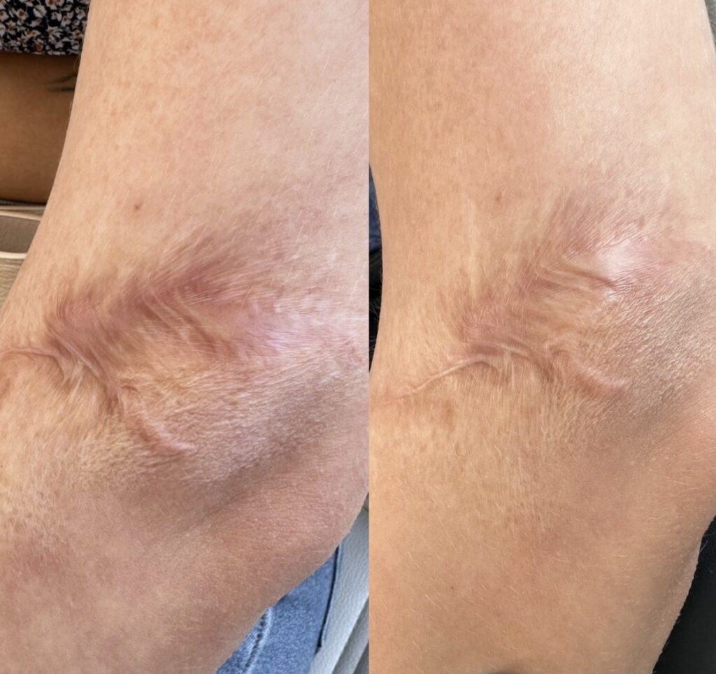 Scar Camouflage Training DAELA Academy