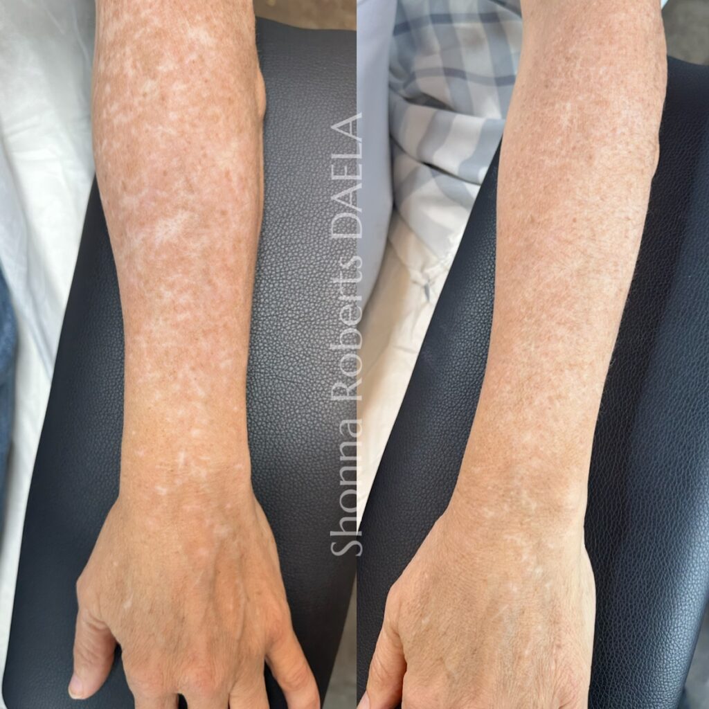 Scar Camouflage Training DAELA Academy