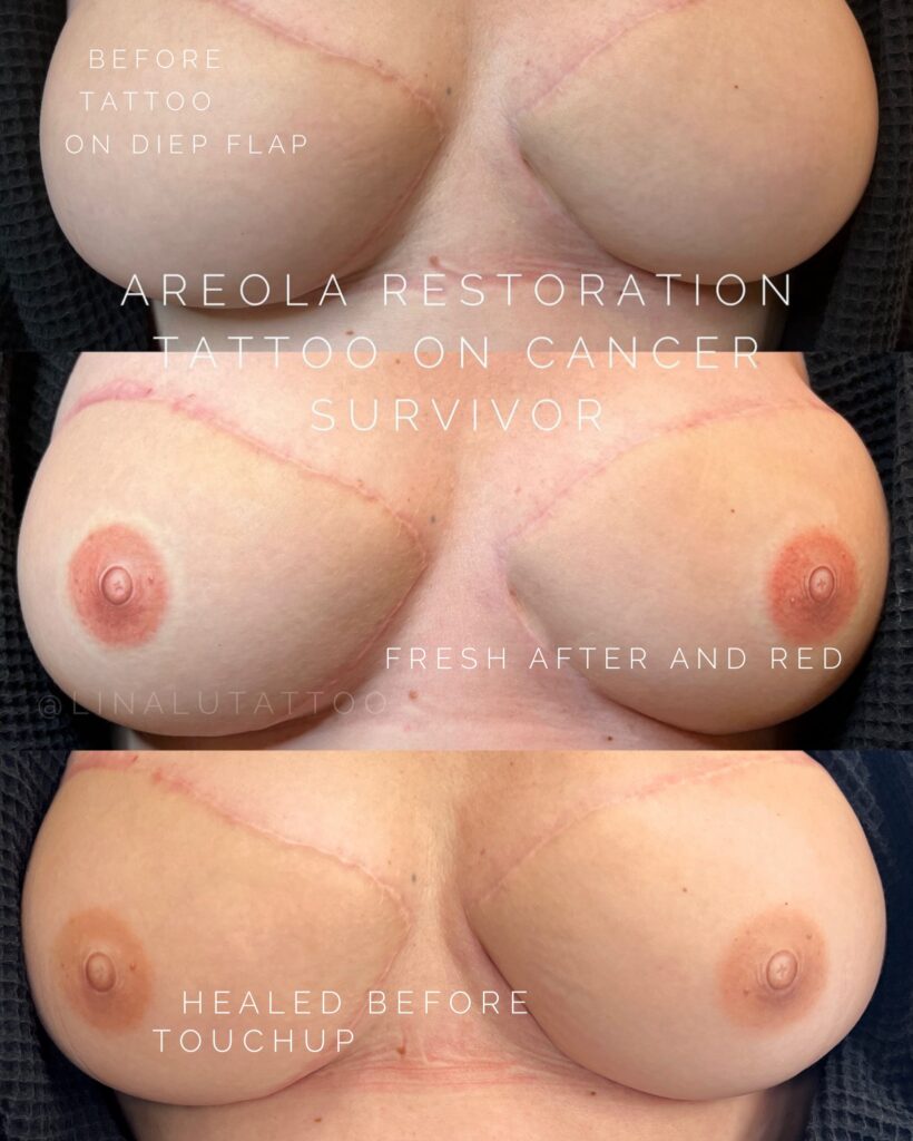 areola restoration tattoo training at daela academy