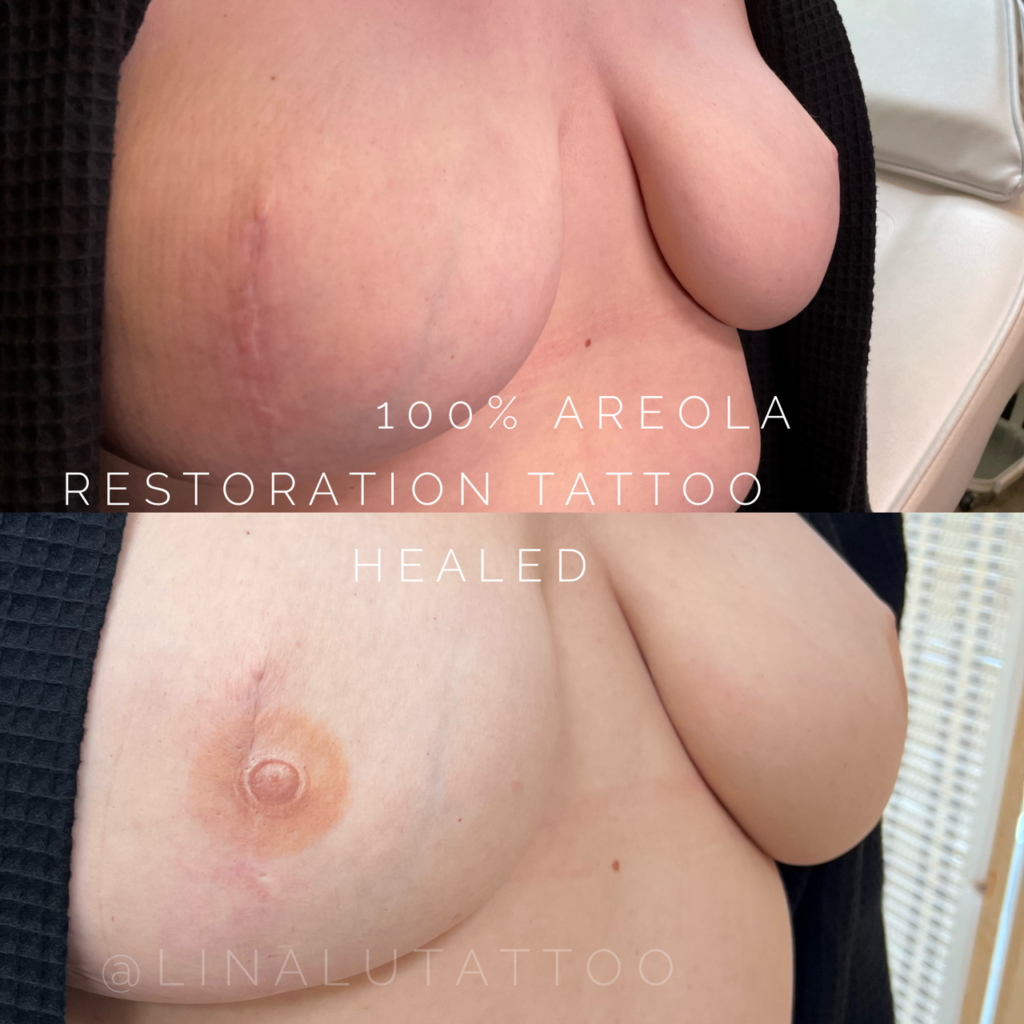 Areola Restoration Tattoo