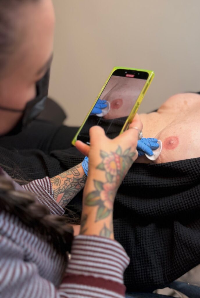 areola restoration training